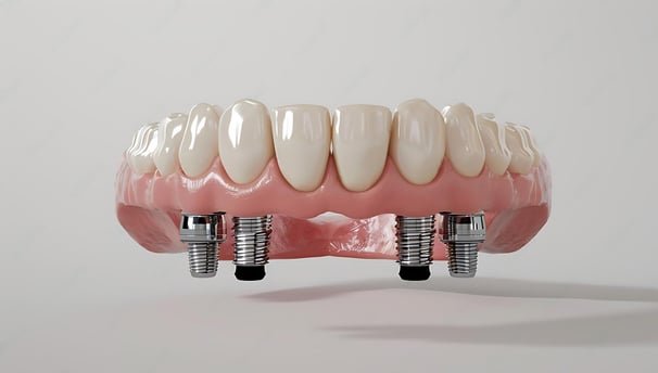 Exames radiográficos e tomografia para implante dentário em Atibaia